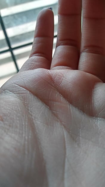 A close-up of a person's hand, showing the skin slightly dry and flaky. The background is blurred, focusing attention on the skin condition as a sign of potential dehydration.